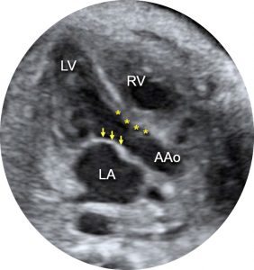 ultrazvucni-pregled-srca-2