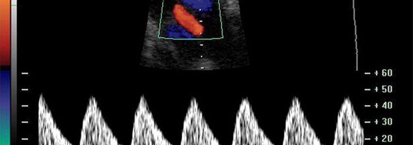 Ultrazvučni pregledi nakon 28. tjedna trudnoće