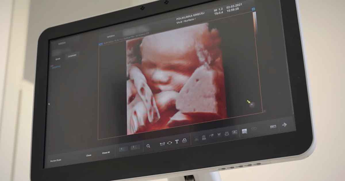 Ultazvučni pregledi nakon 28. tjedna trudnoće - prikaz djeteta na ultrzvuku