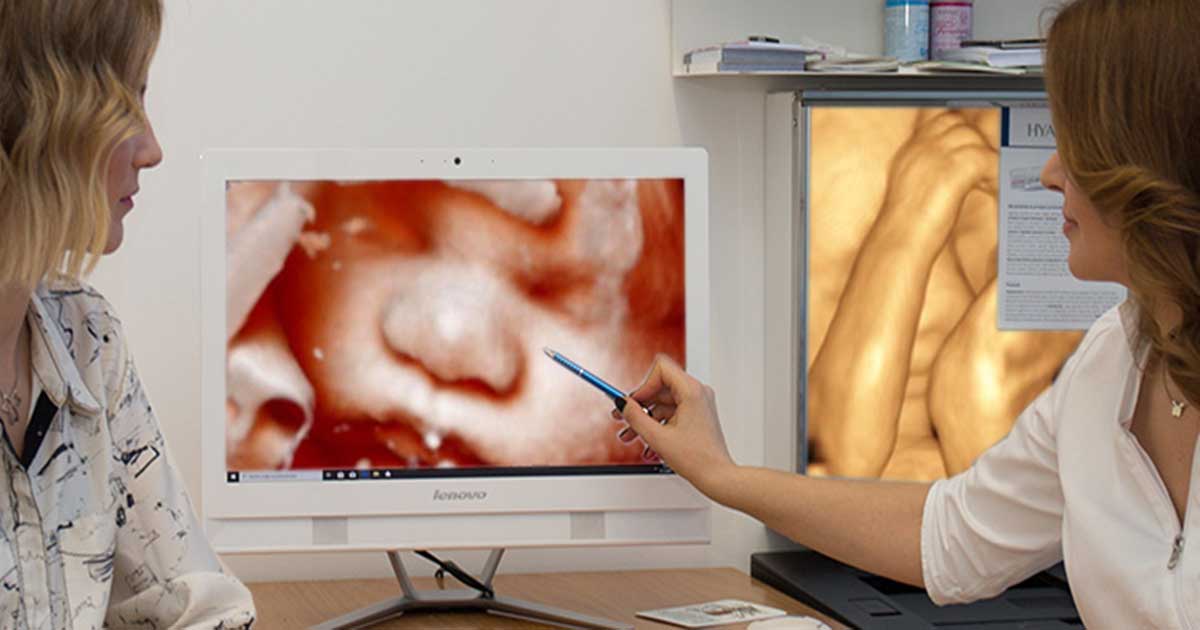 3D ultrazvuk
